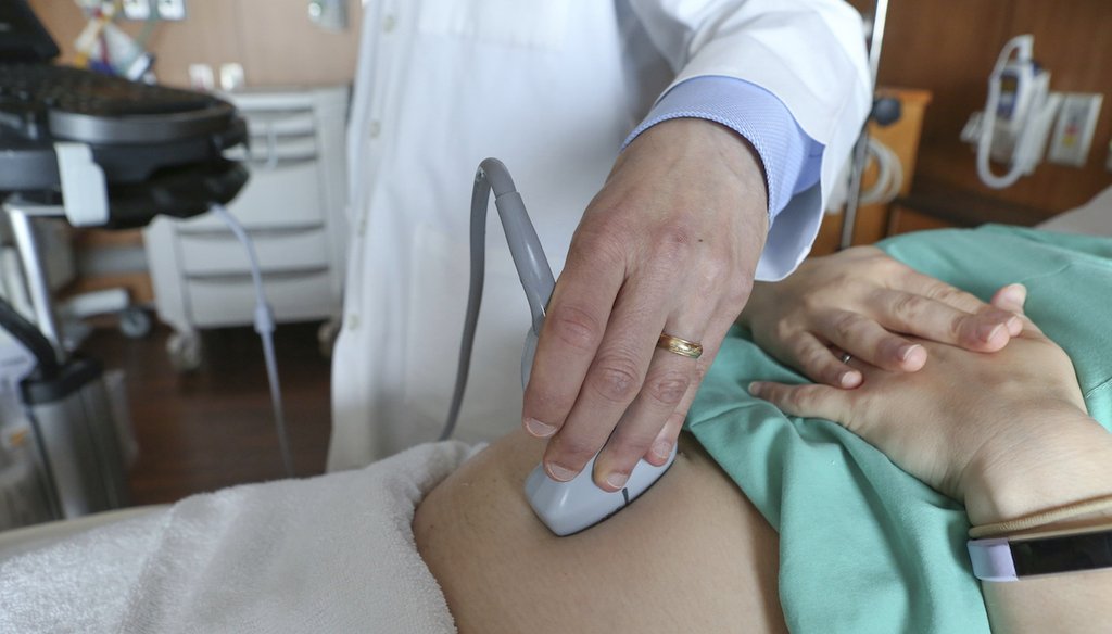 Un médico realiza una ecografía a una mujer embarazada el 7 de agosto de 2018 en un hospital de Chicago. (AP)